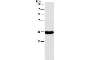 Western Blot analysis of Human fetal liver tissue using FGL1 Polyclonal Antibody at dilution of 1:500