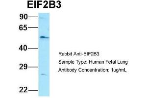Image no. 1 for anti-Eukaryotic Translation Initiation Factor 2B, Subunit 3 Gamma, 58kDa (EIF2B3) (Middle Region) antibody (ABIN2790398)