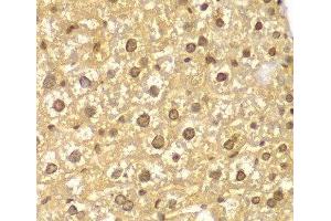 Immunohistochemistry of paraffin-embedded Mouse liver using ASC / TMS1 Polyclonal Antibody at dilution of 1:100 (40x lens).