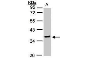 Image no. 2 for anti-O-Sialoglycoprotein Endopeptidase (OSGEP) (Center) antibody (ABIN2856193)