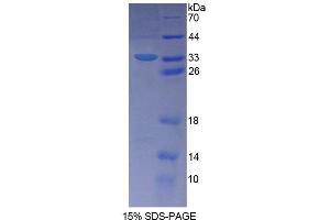 Image no. 1 for Schlafen Family Member 5 (SLFN5) (AA 658-891) protein (His tag) (ABIN6237888)