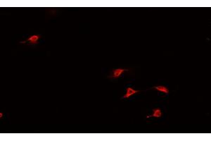 Image no. 1 for anti-Heart and Neural Crest Derivatives Expressed 1 (HAND1) (Internal Region) antibody (ABIN6262148)