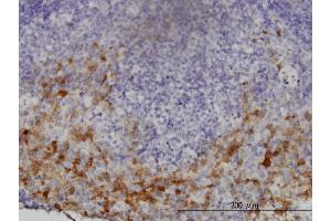 Image no. 1 for anti-GTP Cyclohydrolase 1 (GCH1) (AA 84-172) antibody (ABIN561018)