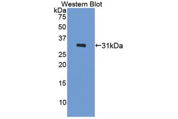 anti-Breast Cancer 2, Early Onset (BRCA2) (AA 2913-3151) antibody