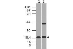 Image no. 1 for anti-Elastase 3B, Pancreatic (ELA3B) (AA 18-227) antibody (ABIN5027106)