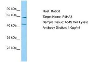 Image no. 1 for anti-Prolyl 4-Hydroxylase, alpha Polypeptide III (P4HA3) (AA 77-126) antibody (ABIN6750125)