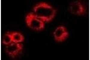 Image no. 1 for anti-WNT Inhibitory Factor 1 (WIF1) antibody (ABIN3197842)