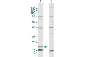 Image no. 1 for anti-Neuregulin 4 (NRG4) (AA 1-115) antibody (ABIN530904)