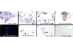 Image no. 6 for anti-SARS-CoV-2 Envelope (SARS-CoV-2 E) (N-Term) antibody (ABIN1031551)