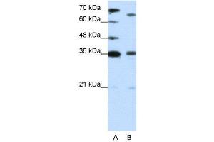 WB Suggested Anti-PRDM13  Antibody Titration: 1.