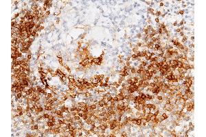 Image no. 1 for anti-Fc Fragment of IgE, Low Affinity II, Receptor For (CD23) (FCER2) (AA 48-321) antibody (ABIN1996213)