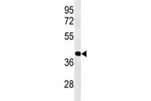 Image no. 2 for anti-Activating Transcription Factor 1 (AFT1) (AA 193-219) antibody (ABIN3029842)