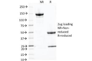 Image no. 1 for anti-Placental Alkaline Phosphatase (ALPP) antibody (ABIN6939451)