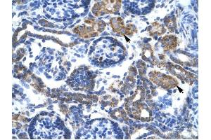 Image no. 1 for anti-Complement Component 4 Binding Protein, beta (C4BPB) (N-Term) antibody (ABIN634490)