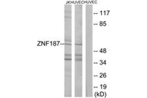anti-Zinc Finger Protein 187 (ZNF187) (AA 51-100) antibody
