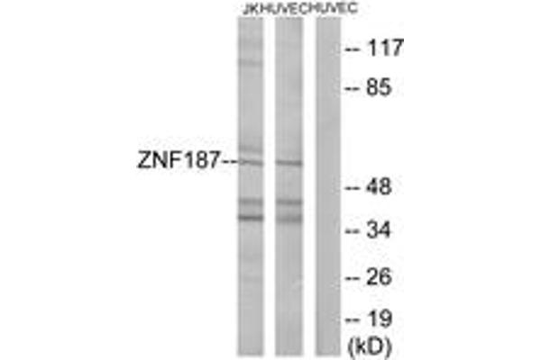 anti-Zinc Finger Protein 187 (ZNF187) (AA 51-100) antibody