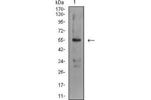Image no. 4 for anti-ASF1 Anti-Silencing Function 1 Homolog B (ASF1B) (AA 1-202) antibody (ABIN5611236)