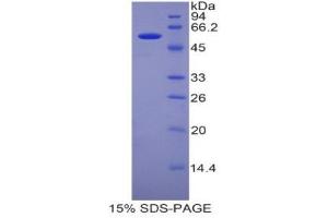Image no. 1 for Pregnancy Zone Protein (PZP) (AA 1224-1495) protein (His tag,GST tag) (ABIN1878429)