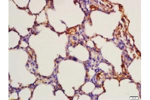 Image no. 2 for anti-Fms-Related tyrosine Kinase 3 (FLT3) (pTyr842) antibody (ABIN684868)