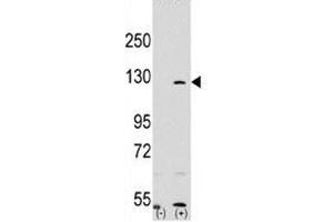 Image no. 4 for anti-Poly (ADP-Ribose) Polymerase 1 (PARP1) (AA 183-214) antibody (ABIN3032164)