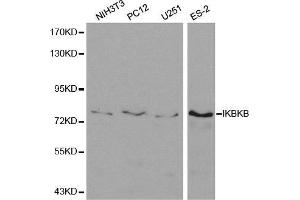 Image no. 2 for anti-Inhibitor of kappa Light Polypeptide Gene Enhancer in B-Cells, Kinase beta (IKBKB) antibody (ABIN3022876)