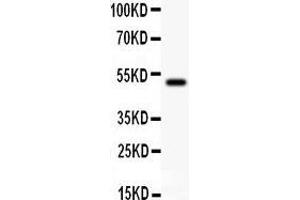 Image no. 3 for anti-E1A Binding Protein P300 (EP300) (AA 2065-2414) antibody (ABIN3042372)