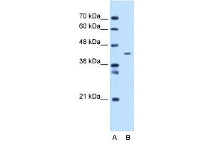 Image no. 1 for anti-Mitochondrial Carrier 1 (MTCH1) (C-Term) antibody (ABIN2773890)