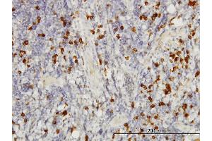 Image no. 2 for anti-SMAD, Mothers Against DPP Homolog 3 (SMAD3) (AA 120-221) antibody (ABIN561714)