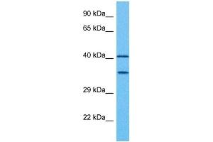 Image no. 4 for anti-Paired Box Gene 2a (PAX2A) (Middle Region) antibody (ABIN2792620)