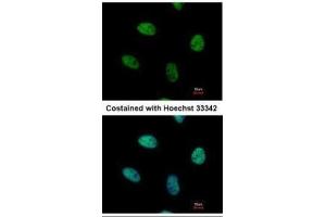 ICC/IF Image Immunofluorescence analysis of paraformaldehyde-fixed HeLa, using NUR77, antibody at 1:500 dilution.