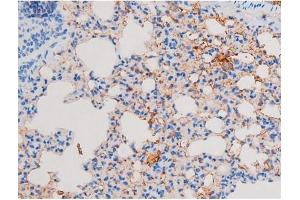 Image no. 3 for anti-Insulin Receptor Substrate 1 (IRS1) (pSer639) antibody (ABIN6256390)