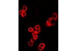 Image no. 1 for anti-Mucosa Associated Lymphoid Tissue Lymphoma Translocation Gene 1 (MALT1) antibody (ABIN3198189)