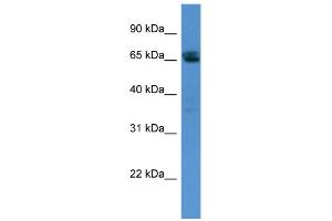Image no. 1 for anti-SWI/SNF Related, Matrix Associated, Actin Dependent Regulator of Chromatin, Subfamily D, Member 3 (SMARCD3) (N-Term) antibody (ABIN2776387)