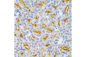 Immunohistochemistry of paraffin-embedded rat kidney using MyD88 Antibody (ABIN6128257, ABIN6144228, ABIN6144229 and ABIN6213986) at dilution of 1:100 (40x lens).
