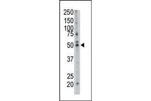 Image no. 3 for anti-Farnesyl-Diphosphate Farnesyltransferase 1 (FDFT1) (AA 1-30), (N-Term) antibody (ABIN389051)