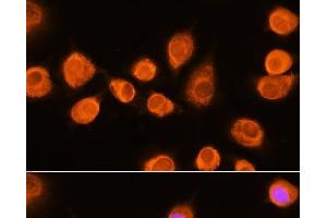 ASPM anticorps