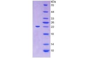 Image no. 4 for Lecithin-Cholesterol Acyltransferase (LCAT) ELISA Kit (ABIN6720598)