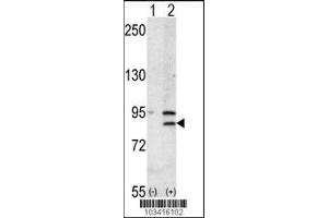Image no. 2 for anti-Bromodomain Containing 2 (BRD2) (AA 170-200) antibody (ABIN392609)