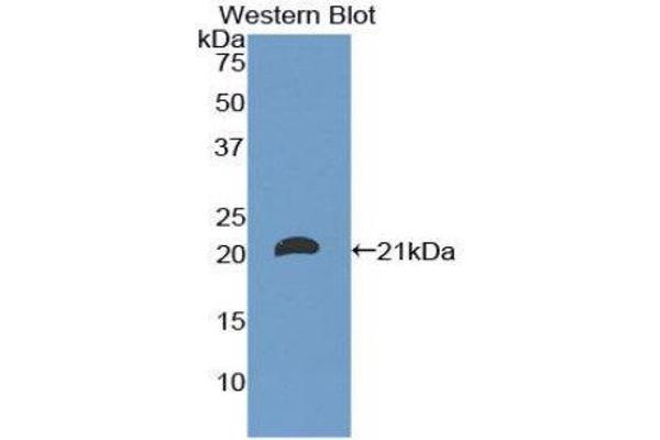 CD8B antibody  (AA 22-170)