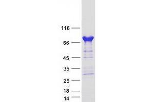 Image no. 1 for phosphodiesterase 4C, CAMP-Specific (PDE4C) (Transcript Variant 2) protein (Myc-DYKDDDDK Tag) (ABIN2728516)