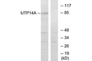 Image no. 1 for anti-UTP14, U3 Small Nucleolar Ribonucleoprotein, Homolog A (UTP14A) (AA 321-370) antibody (ABIN1534097)