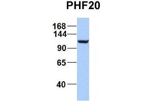Image no. 3 for anti-PHD Finger Protein 20 (PHF20) (C-Term) antibody (ABIN2774935)