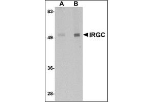 Image no. 2 for anti-Immunity-Related GTPase Family, Cinema (IRGC) (C-Term) antibody (ABIN500066)