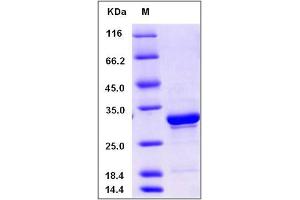 Image no. 1 for 5'-Nucleotidase, Cytosolic III (NT5C3) (AA 12-297), (Mature) protein (ABIN2005962)