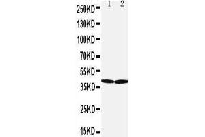 Image no. 2 for anti-Solute Carrier Family 10 (Sodium/bile Acid Cotransporter Family), Member 1 (SLC10A1) (AA 141-154), (Middle Region) antibody (ABIN3044254)