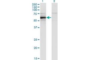 Image no. 2 for anti-Hemopoietic Cell Kinase (HCK) (AA 1-505) antibody (ABIN561236)