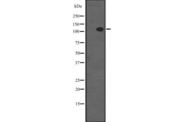 SYCP1 antibody  (C-Term)