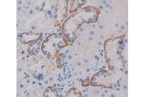 Image no. 3 for anti-Transporter 1, ATP-Binding Cassette, Sub-Family B (MDR/TAP) (TAP1) (AA 525-808) antibody (ABIN1871341)