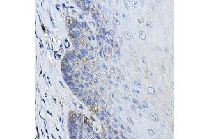Immunohistochemistry of paraffin-embedded human esophagus using CD46 Rabbit pAb (ABIN3022325, ABIN3022326, ABIN1512715, ABIN1513898 and ABIN6218741) at dilution of 1:100 (40x lens).