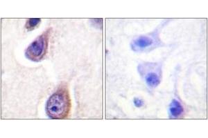 Image no. 1 for anti-Phospholipase D1 (PLD1) (AA 527-576), (pSer561) antibody (ABIN1531469)